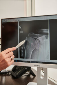 Digitales Röntgen Vimos Orthopädie